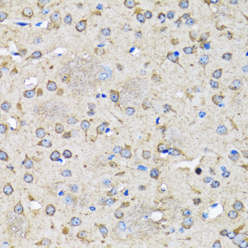 Immunohistochemistry of paraffin-embedded Rat brain using LC3B Polyclonal Antibody at dilution of  1:100 (40x lens).