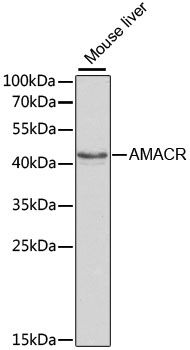 Western blot analysis of extracts of Mouse liver using AMACR Polyclonal Antibody at dilution of 1:1000.