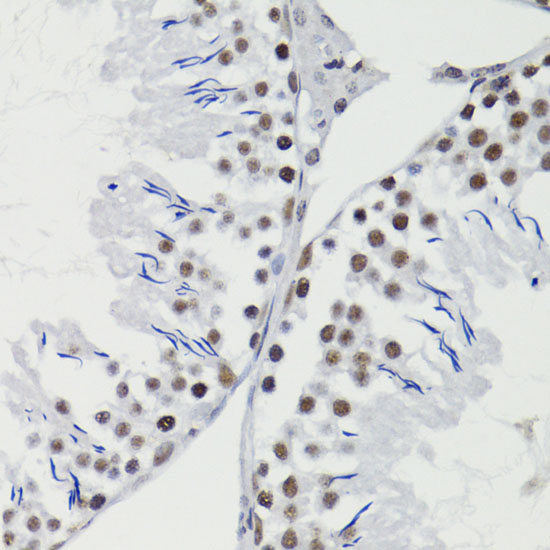 Immunohistochemistry of paraffin-embedded Rat testis using Bcl-2 Polyclonal Antibody at dilution of  1:200 (40x lens).