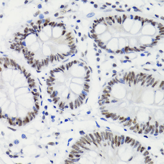 Immunohistochemistry of paraffin-embedded Human stomach using Bcl-2 Polyclonal Antibody at dilution of  1:200 (40x lens).