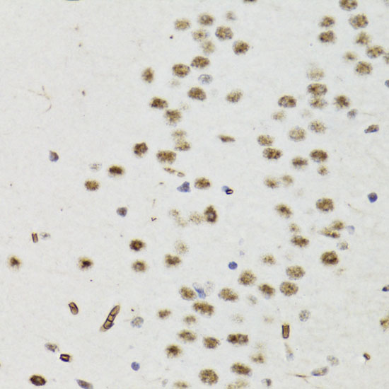 Immunohistochemistry of paraffin-embedded Mouse brain using Bcl-2 Polyclonal Antibody at dilution of  1:200 (40x lens).