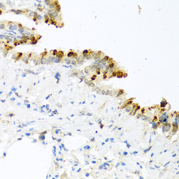 Immunohistochemistry of paraffin-embedded Mouse lung using BMP4 Polyclonal Antibody at dilution of  1:100 (40x lens).