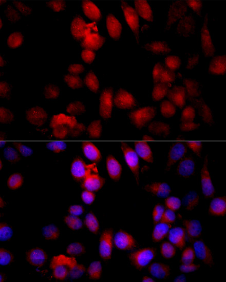 Immunofluorescence analysis of HeLa cells using Caspase-3 Polyclonal Antibody at dilution of  1:100 (40x lens). Blue: DAPI for nuclear staining.