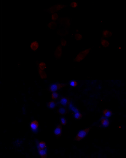Immunofluorescence analysis of NIH/3T3 cells using Caspase-3 Polyclonal Antibody at dilution of  1:100 (40x lens). Blue: DAPI for nuclear staining.
