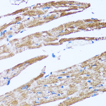 Immunohistochemistry of paraffin-embedded Rat heart using Caspase-3 Polyclonal Antibody at dilution of  1:100 (40x lens).