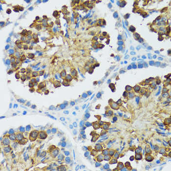 Immunohistochemistry of paraffin-embedded Rat testis using Caspase-3 Polyclonal Antibody at dilution of  1:100 (40x lens).