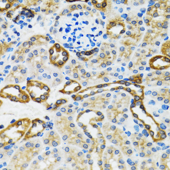 Immunohistochemistry of paraffin-embedded Rat kidney using Caspase-3 Polyclonal Antibody at dilution of  1:100 (40x lens).