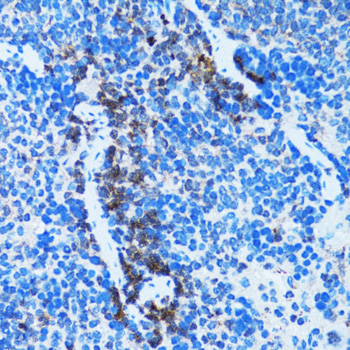 Immunohistochemistry of paraffin-embedded Rat spleen using Caspase-3 Polyclonal Antibody at dilution of  1:100 (40x lens).