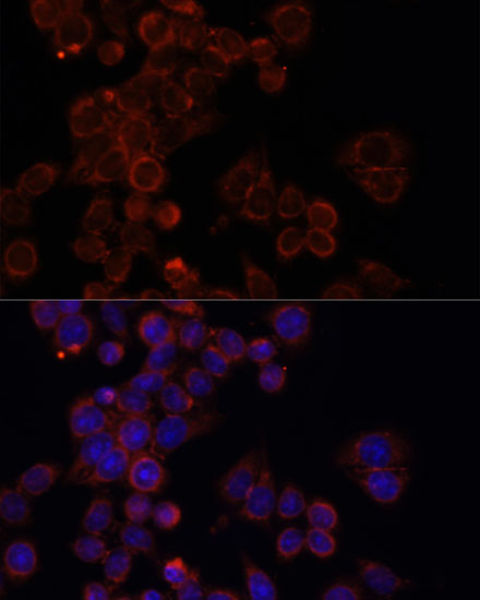 Immunofluorescence analysis of HeLa cells using mTOR Polyclonal Antibody at dilution of  1:100. Blue: DAPI for nuclear staining.