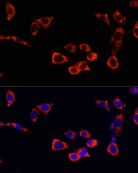 Immunofluorescence analysis of NIH/3T3 cells using mTOR Polyclonal Antibody at dilution of  1:100. Blue: DAPI for nuclear staining.