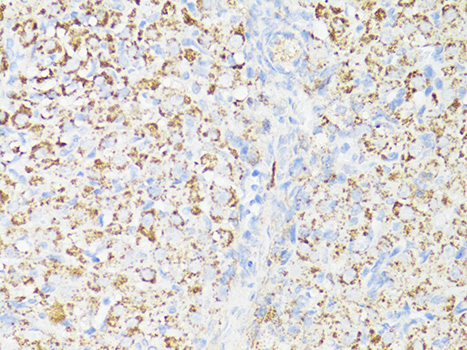 Immunohistochemistry of paraffin-embedded Rat ovary using mTOR Polyclonal Antibody at dilution of  1:150 (40x lens).