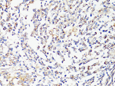 Immunohistochemistry of paraffin-embedded Human tonsil using mTOR Polyclonal Antibody at dilution of  1:150 (40x lens).