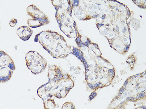 Immunohistochemistry of paraffin-embedded Human placenta using mTOR Polyclonal Antibody at dilution of  1:150 (40x lens).