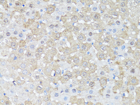 Immunohistochemistry of paraffin-embedded Mouse liver using mTOR Polyclonal Antibody at dilution of  1:150 (40x lens).