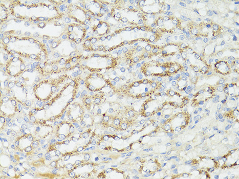 Immunohistochemistry of paraffin-embedded Mouse kidney using mTOR Polyclonal Antibody at dilution of  1:150 (40x lens).