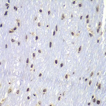 Immunohistochemistry of paraffin-embedded Mouse brain using Lyn Polyclonal Antibody at dilution of  1:100 (40x lens).