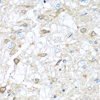 Immunohistochemistry of paraffin-embedded Rat brain using RAC2 Polyclonal Antibody at dilution of  1:100 (40x lens).