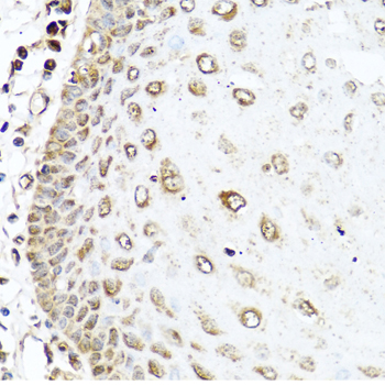 Immunohistochemistry of paraffin-embedded Human esophagus using RAC2 Polyclonal Antibody at dilution of  1:100 (40x lens).