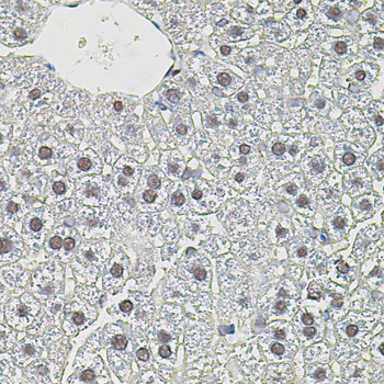Immunohistochemistry of paraffin-embedded Mouse liver using MYC Polyclonal Antibody at dilution of  1:100 (40x lens).