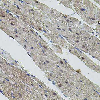 Immunohistochemistry of paraffin-embedded Rat heart using MYC Polyclonal Antibody at dilution of  1:100 (40x lens).