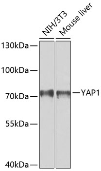 Western blot analysis of extracts of various cell lines using YAP1 Polyclonal Antibody at dilution of 1:1000.