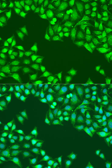 Immunofluorescence analysis of U2OS cells using JAK2 Polyclonal Antibody at dilution of  1:100. Blue: DAPI for nuclear staining.