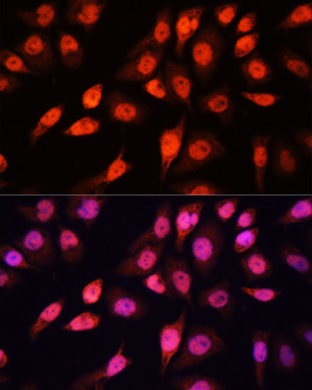 Immunofluorescence analysis of HeLa cells using SOX2 Polyclonal Antibody at dilution of  1:100 (40x lens). Blue: DAPI for nuclear staining.