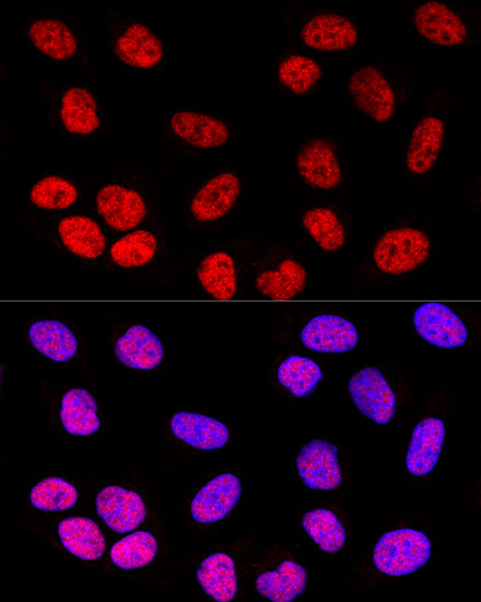 Confocal immunofluorescence analysis of U-2 OS cells using SOX2 Polyclonal Antibody at dilution of  1:200. Blue: DAPI for nuclear staining.
