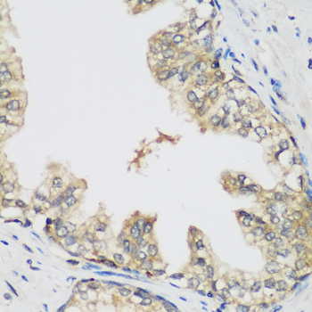 Immunohistochemistry of paraffin-embedded Human prostate using RRM1 Polyclonal Antibody at dilution of  1:200 (40x lens).