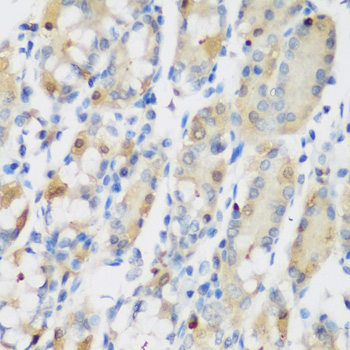 Immunohistochemistry of paraffin-embedded Human stomach using RRM1 Polyclonal Antibody at dilution of  1:200 (40x lens).