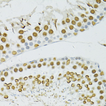 Immunohistochemistry of paraffin-embedded Rat testis using BRCA1 Polyclonal Antibody at dilution of  1:100 (40x lens).