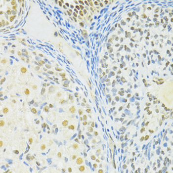 Immunohistochemistry of paraffin-embedded Rat ovary using BRCA1 Polyclonal Antibody at dilution of  1:100 (40x lens).