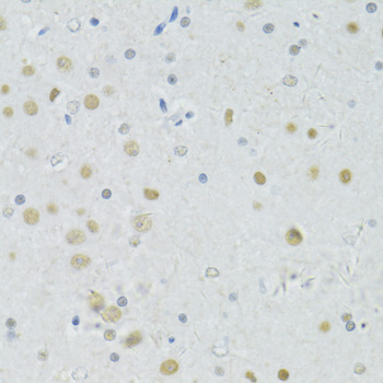 Immunohistochemistry of paraffin-embedded Rat brain using BRCA1 Polyclonal Antibody at dilution of  1:100 (40x lens).