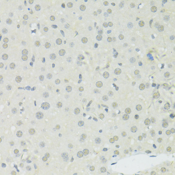 Immunohistochemistry of paraffin-embedded Mouse liver using BRCA1 Polyclonal Antibody at dilution of  1:100 (40x lens).