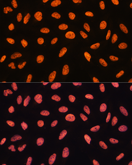 Immunofluorescence analysis of U20S cells using CHD4 Polyclonal Antibody at dilution of  1:100. Blue: DAPI for nuclear staining.