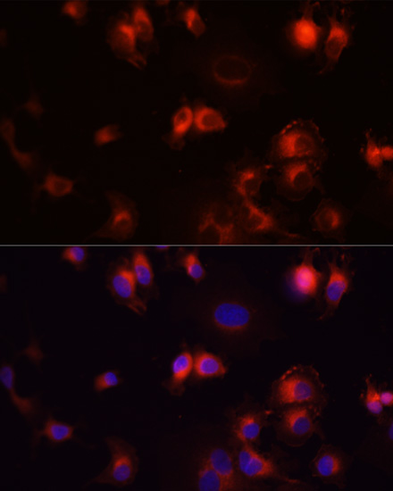 Immunofluorescence analysis of A431 cells using EGFR Polyclonal Antibody at dilution of  1:100 (40x lens). Blue: DAPI for nuclear staining.