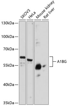 Western blot analysis of extracts of various cell lines using A1BG Polyclonal Antibody at dilution of 1:3000.