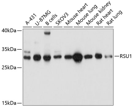 Western blot analysis of extracts of various cell lines using RSU1 Polyclonal Antibody at dilution of 1:1000.