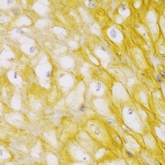 Immunohistochemistry of paraffin-embedded Human esophagus using ACTN1 Polyclonal Antibody at dilution of  1:100 (40x lens).