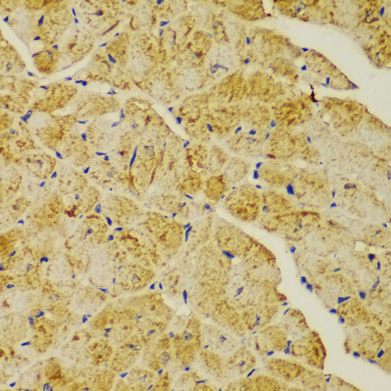 Immunohistochemistry of paraffin-embedded Mouse heart using ACTN1 Polyclonal Antibody at dilution of  1:100 (40x lens).