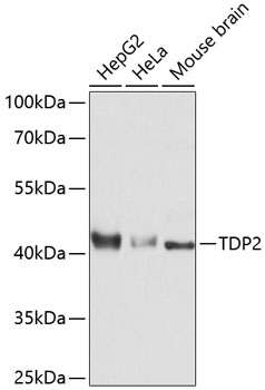 Western blot analysis of extracts of various cell lines using TDP2 Polyclonal Antibody at dilution of 1:3000.