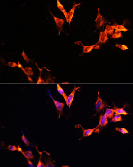 Immunofluorescence analysis of NIH-3T3 cells using LAMTOR1 Polyclonal Antibody at dilution of  1:100 (40x lens). Blue: DAPI for nuclear staining.