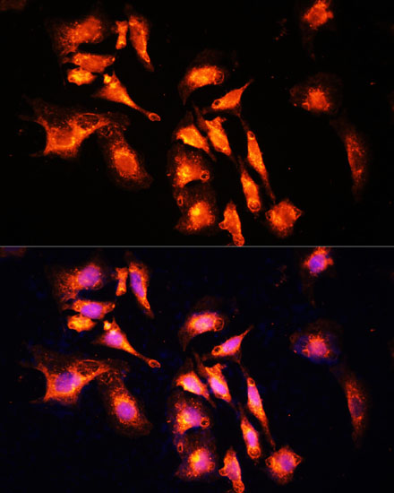 Immunofluorescence analysis of U-2 OS cells using LAMTOR1 Polyclonal Antibody at dilution of  1:100 (40x lens). Blue: DAPI for nuclear staining.