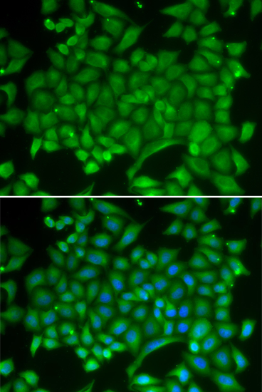 Immunofluorescence analysis of MCF-7 cells using RAB11A Polyclonal Antibody