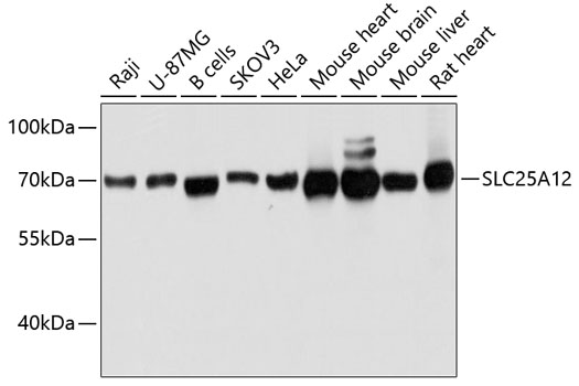 Western blot analysis of extracts of various cell lines using SLC25A12 Polyclonal Antibody at dilution of 1:3000.