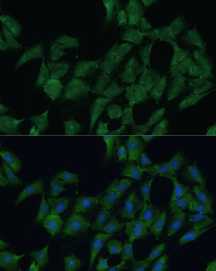 Immunofluorescence analysis of C6 cells using DDX3Y Polyclonal Antibody at dilution of  1:100 (40x lens). Blue: DAPI for nuclear staining.