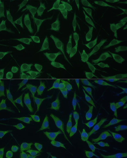 Immunofluorescence analysis of L929 cells using DDX3Y Polyclonal Antibody at dilution of  1:100 (40x lens). Blue: DAPI for nuclear staining.
