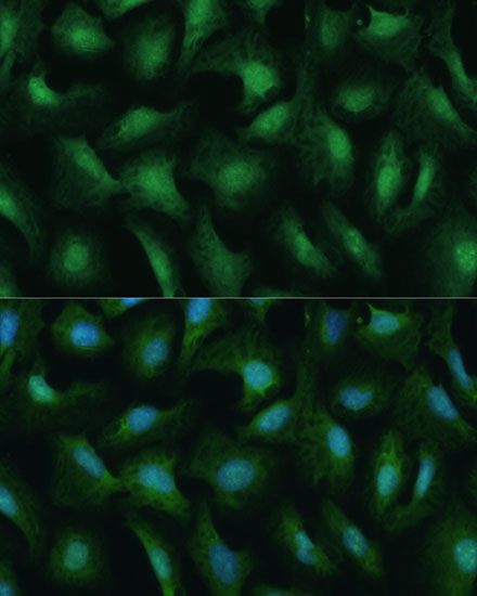 Immunofluorescence analysis of U-2 OS cells using DDX3Y Polyclonal Antibody at dilution of  1:100 (40x lens). Blue: DAPI for nuclear staining.