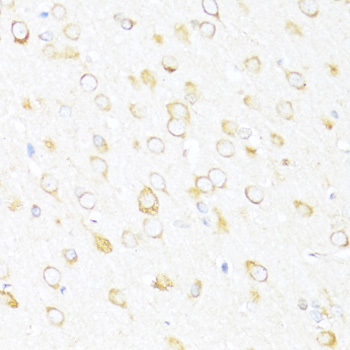 Immunohistochemistry of paraffin-embedded Rat brain using DDX3Y Polyclonal Antibody at dilution of  1:100 (40x lens).