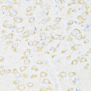 Immunohistochemistry of paraffin-embedded Mouse brain using DDX3Y Polyclonal Antibody at dilution of  1:100 (40x lens).
